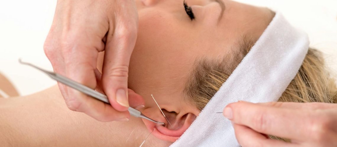 Acupuncture pour arrêter de fumer : est-ce efficace ?